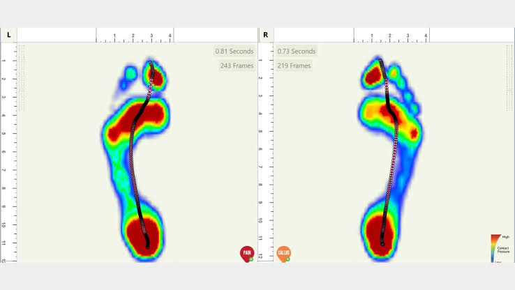 Pressure Mapping